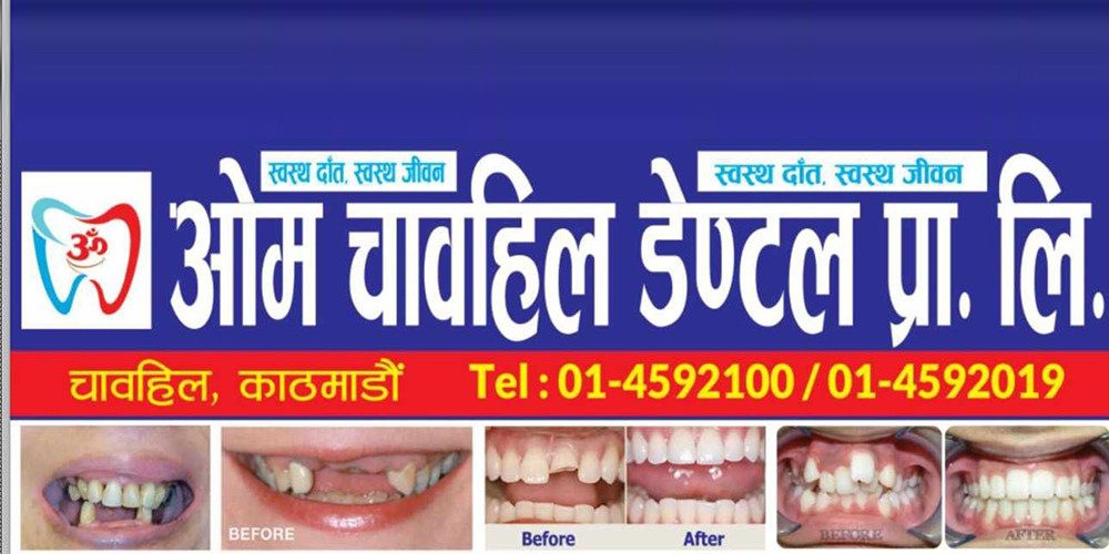 विश्व मुख स्वास्थ्य दिवसका अवसरमा ओम चावहिल डेण्टलले एक महिनासम्म निशुल्क दन्त परीक्षण गर्ने 