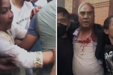 ‘सभापति देउवामाथि गरिएको सांघातिक आक्रमणलाई म जघन्य अपराधको कोटीमा राख्छु’